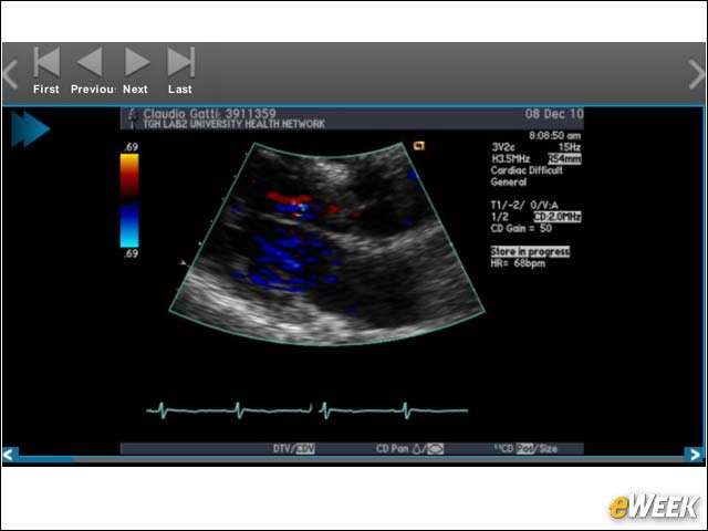 Viewing Radiology Images
