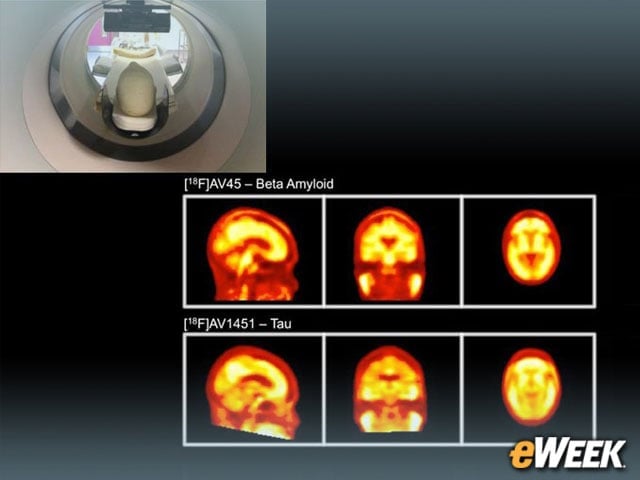 Rendering Better Brain Scans