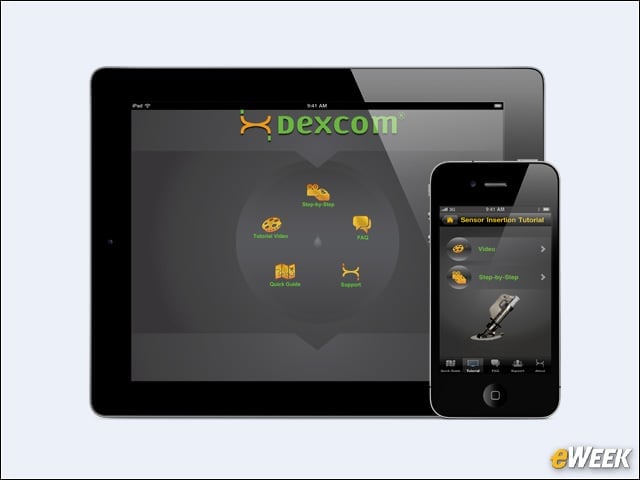 Dexcom 