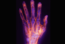 Vein Pattern Scanning Enables Device-Free Instant Payments